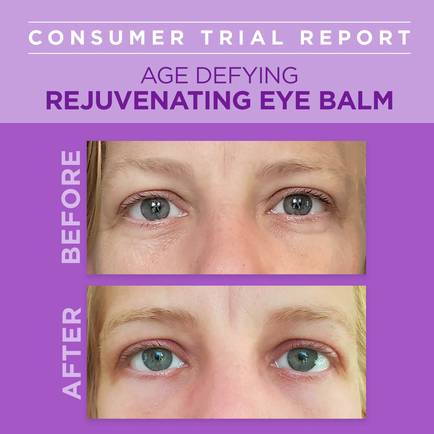 Age Defying Rejuvenating Plant-Based Retinol Alternative Eye Balm - Image 3