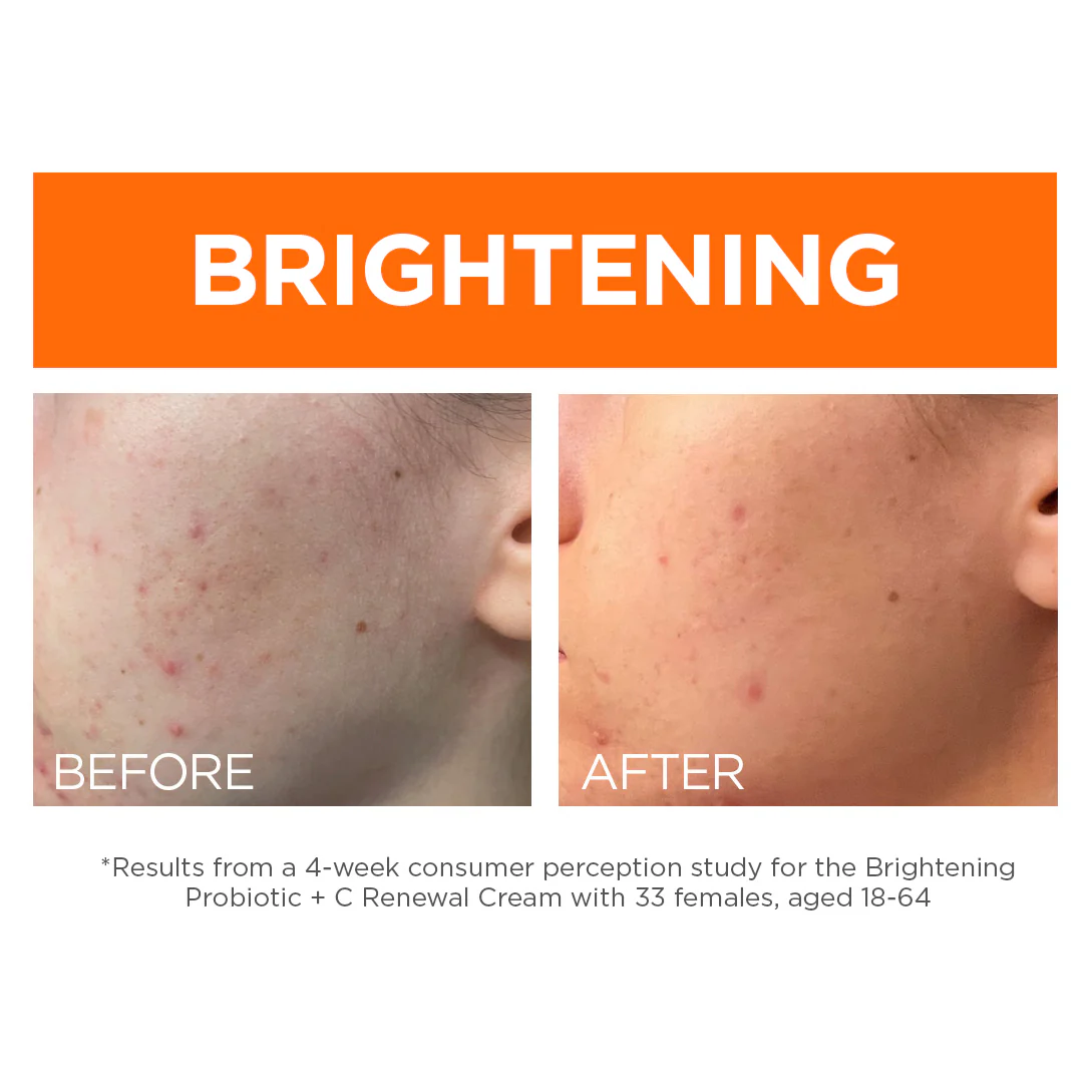 Brightening Probiotic + Vitamin C Renewal Cream - Image 5